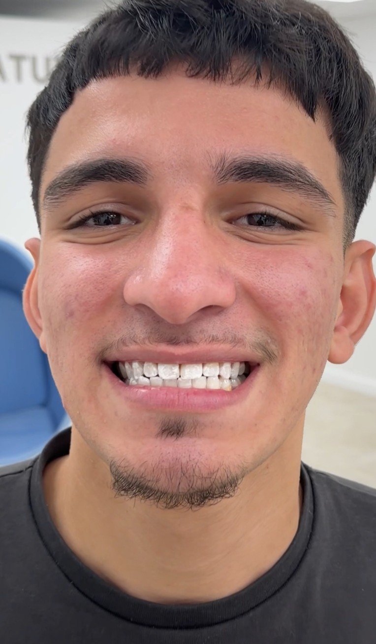 After Result
