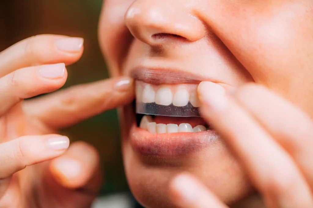 Nahaufnahme einer Person, die einen transparenten Whitening Strip (Bleaching-Streifen) zur Zahnaufhellung auf die obere Zahnreihe aufträgt.